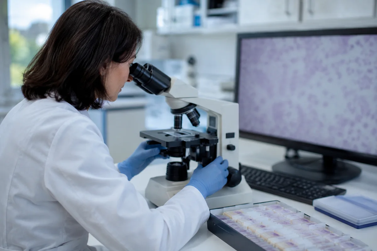 Imagem ilustrativa: Patologista observa lâmina ao microscópio com tela desfocada e amostra fechada, genética tumoral.